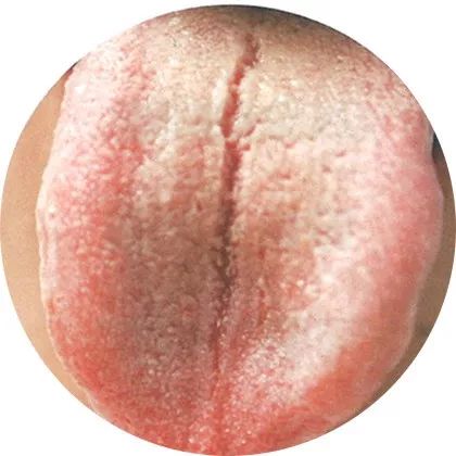 裂纹舌1 裂纹舌1