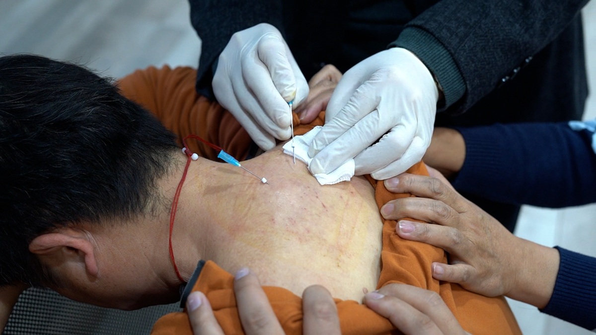 中域教育第9期王氏刺络排瘀疗法学术交流会（青岛站）