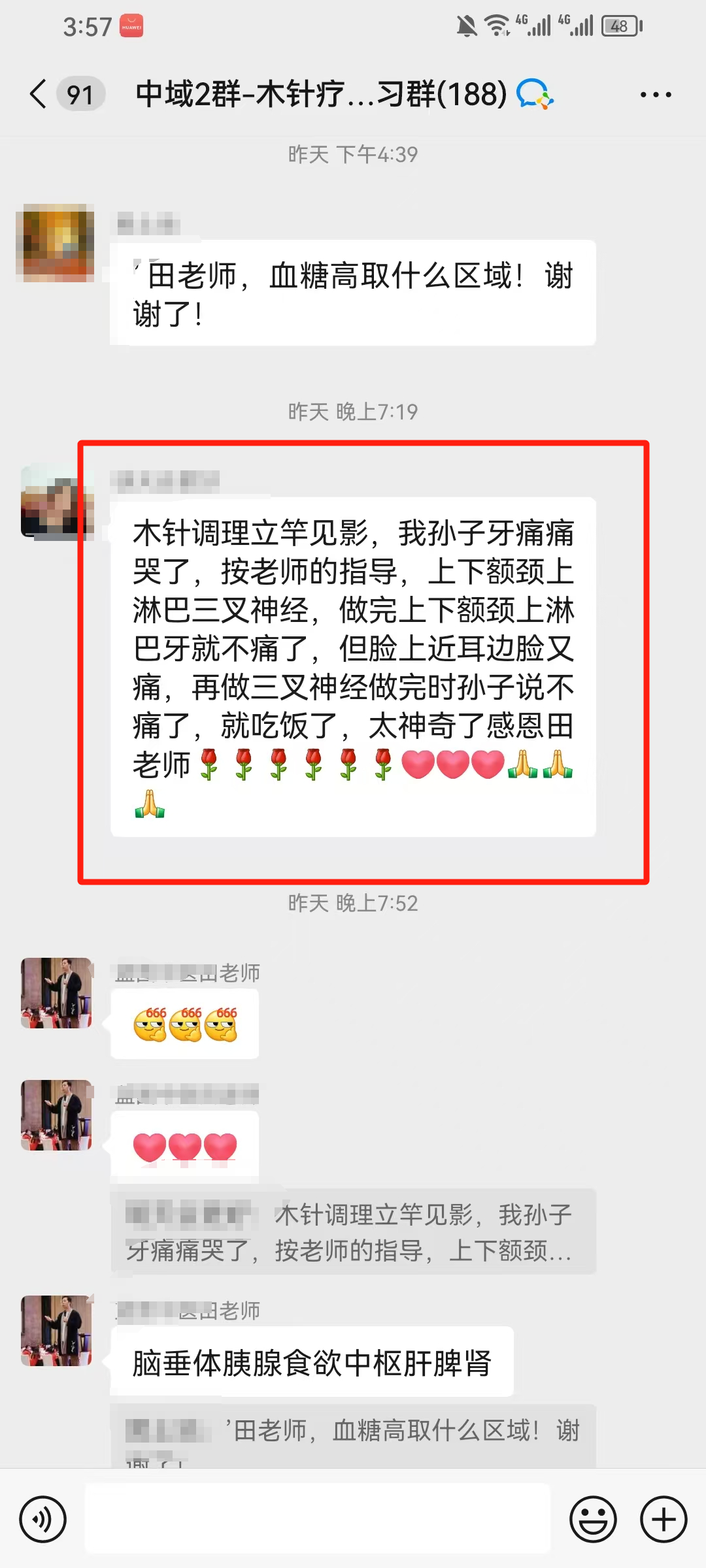 木针疗法学员反馈：孙子牙痛痛哭了，做完牙就不痛了！