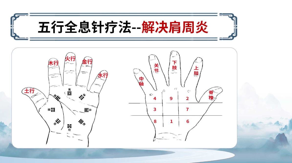 杨氏全息针——肩周炎调理方法(附针灸位置图)! 杨氏全息针——肩周炎调理方法(附针灸位置图)!