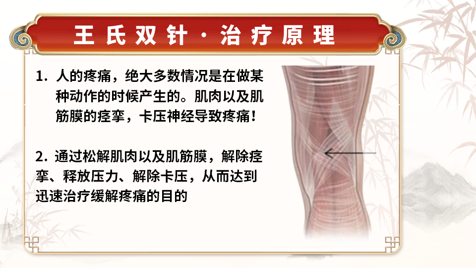 王氏实战双针术的进针深度仅 3 - 5mm，这一浅进针的方式极大地降低了操作风险，避免了对神经、血管和脏器的损伤，即使是毫无经验的初学者也能放心操作。