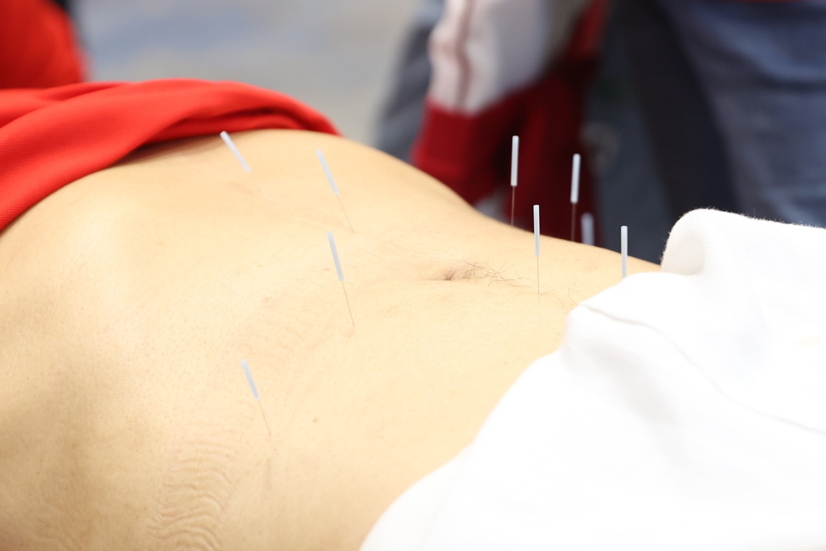 解密曹大福 “三生针法”:从理论到实操的完整体系! 解密曹大福 “三生针法”:从理论到实操的完整体系!