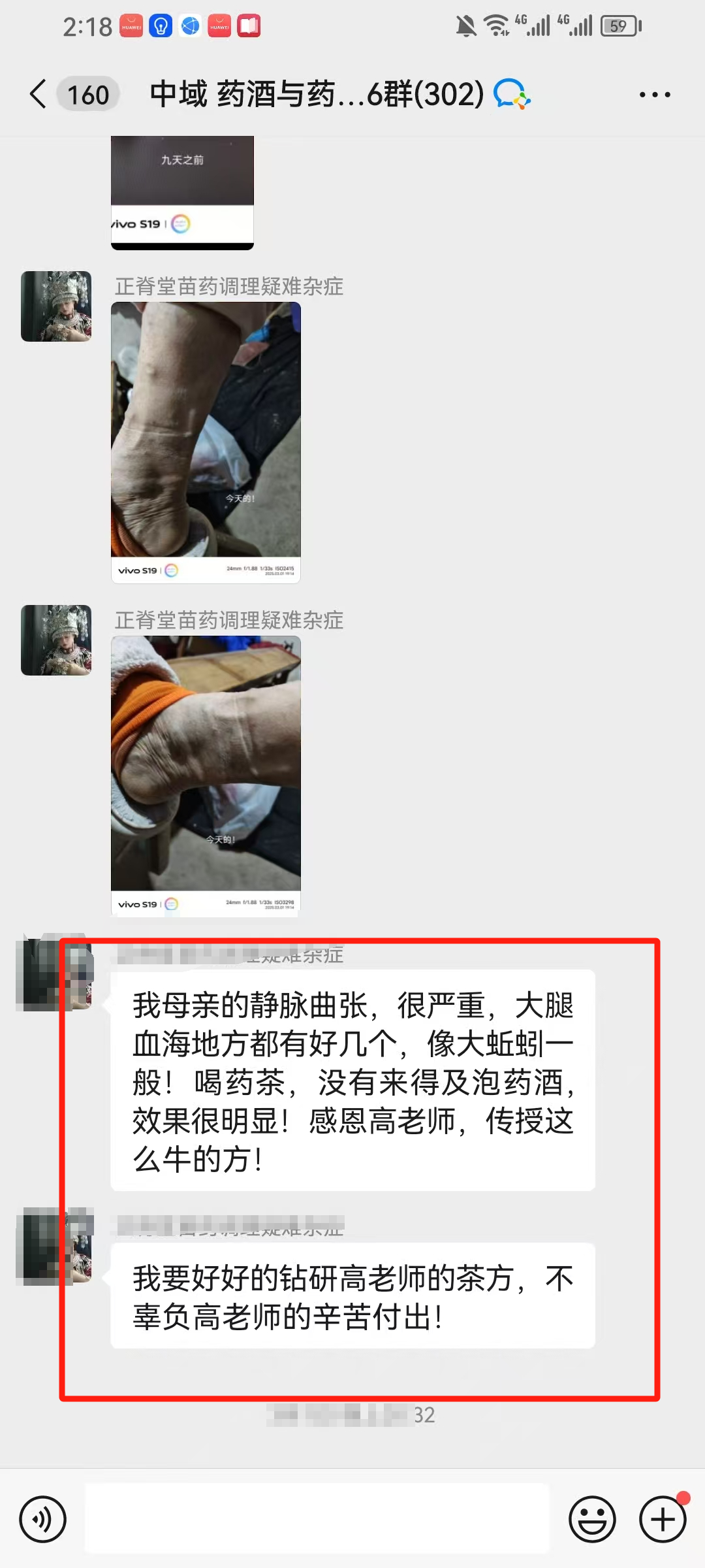 药酒与药茶学员反馈：母亲的静脉曲张，泡药酒效果很明显！