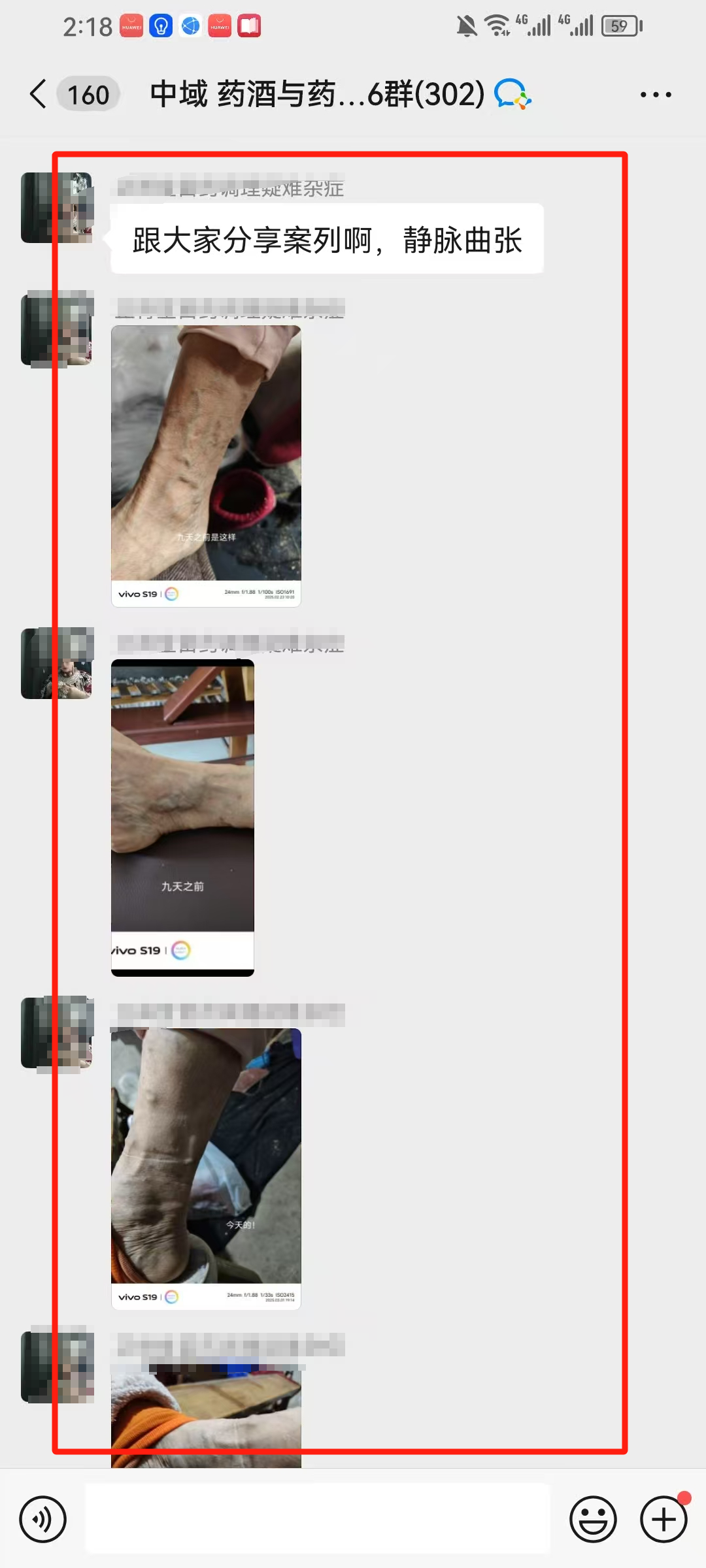 药酒与药茶学员反馈：母亲的静脉曲张，泡药酒效果很明显！