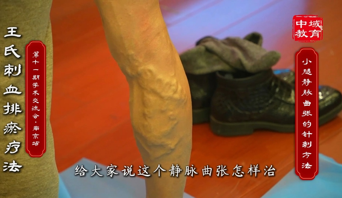 中域教育第 11 期王氏刺血排瘀疗法学术交流会(南京站)圆满落幕! 中域教育第 11 期王氏刺血排瘀疗法学术交流会(南京站)圆满落幕!