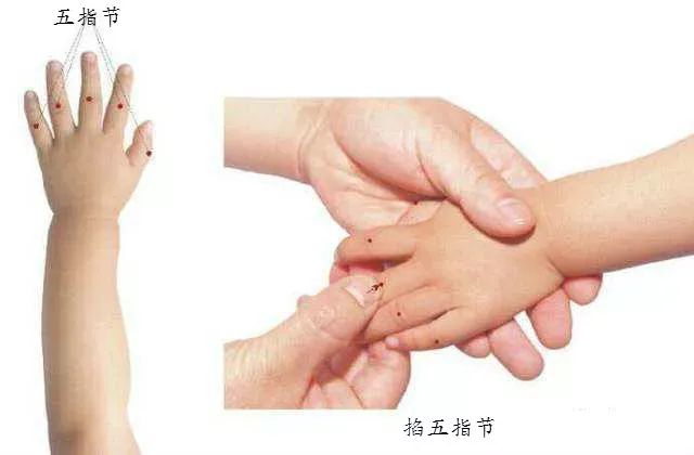 中医小儿推拿——五指节 中医小儿推拿——五指节