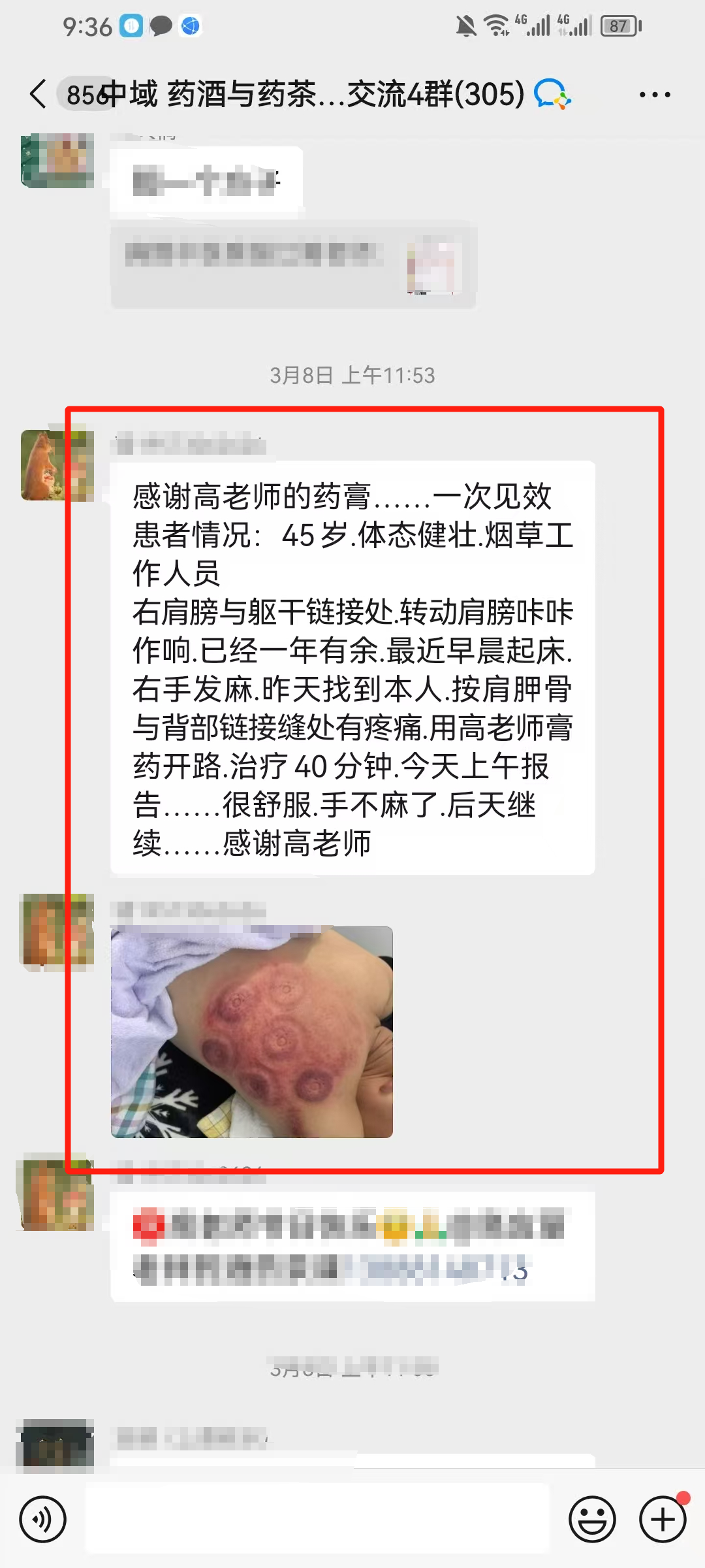 药酒与药茶学员反馈：右手发麻，肩胛骨与背部链接缝处疼，用高老师膏药很舒服！