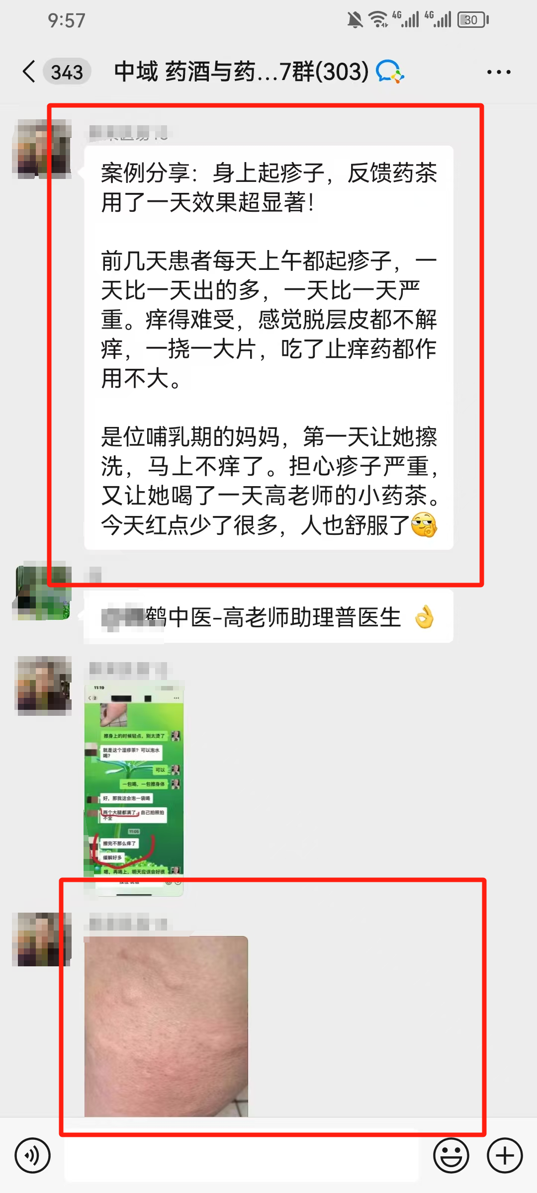药酒与药茶学员反馈：身上起疹子，药茶用了一天效果超显著！