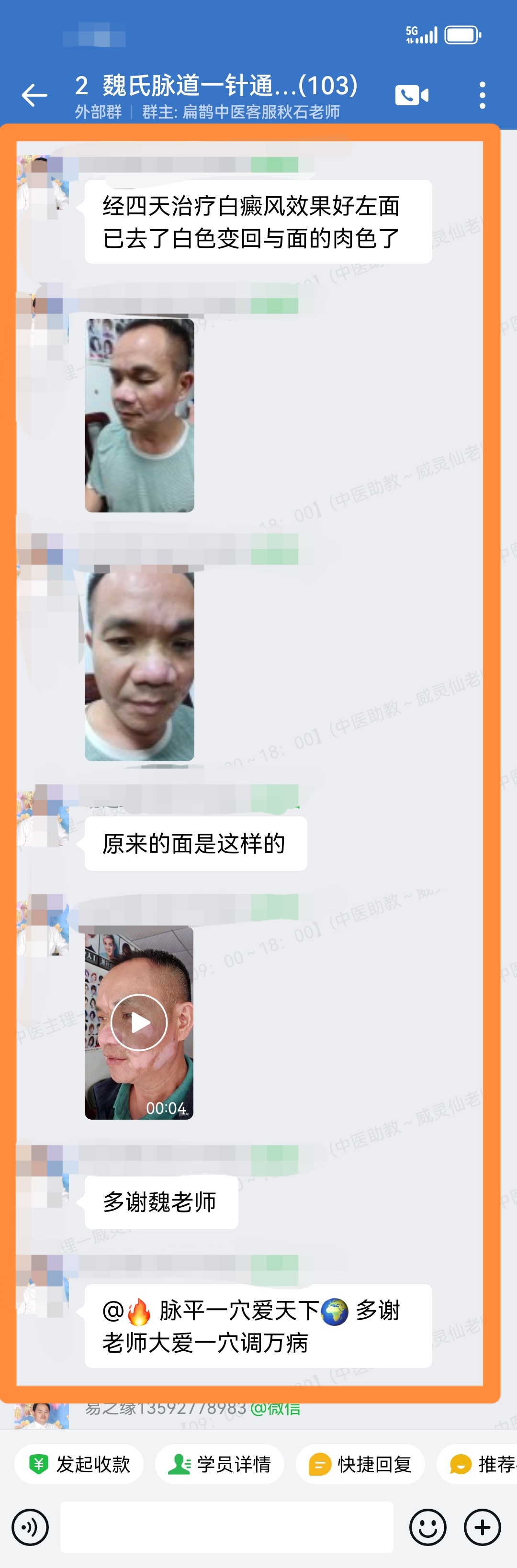 魏氏一针通学员反馈：调理患者白癜风，第四天白色皮肤就出现了血色修复！