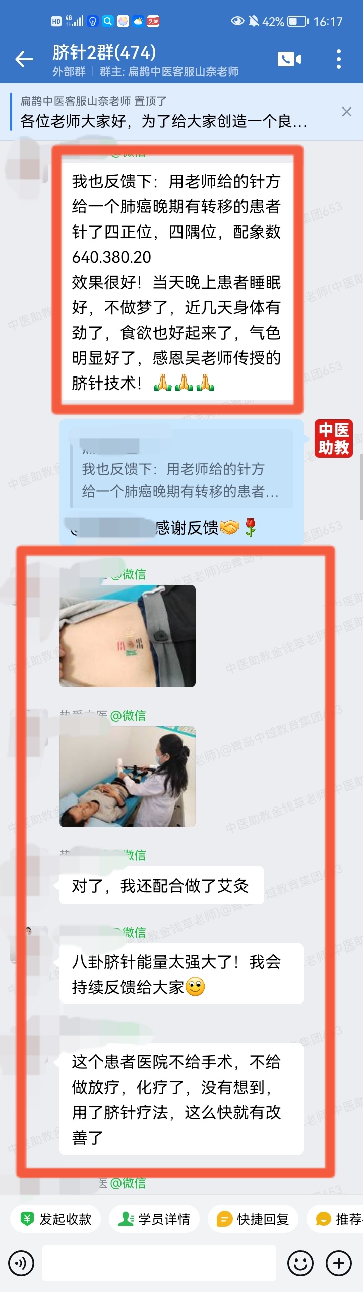 太极八卦脐针反馈:脐针调理失眠多梦,气色食欲等都有好转! 太极八卦脐针反馈:脐针调理失眠多梦,气色食欲等都有好转!