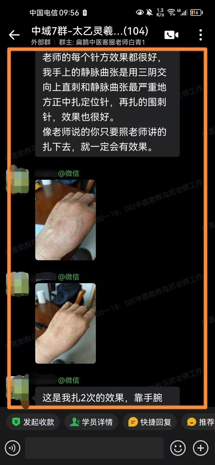 太乙灵羲术学员反馈：运用古今老师针方，静脉曲张明显好转！