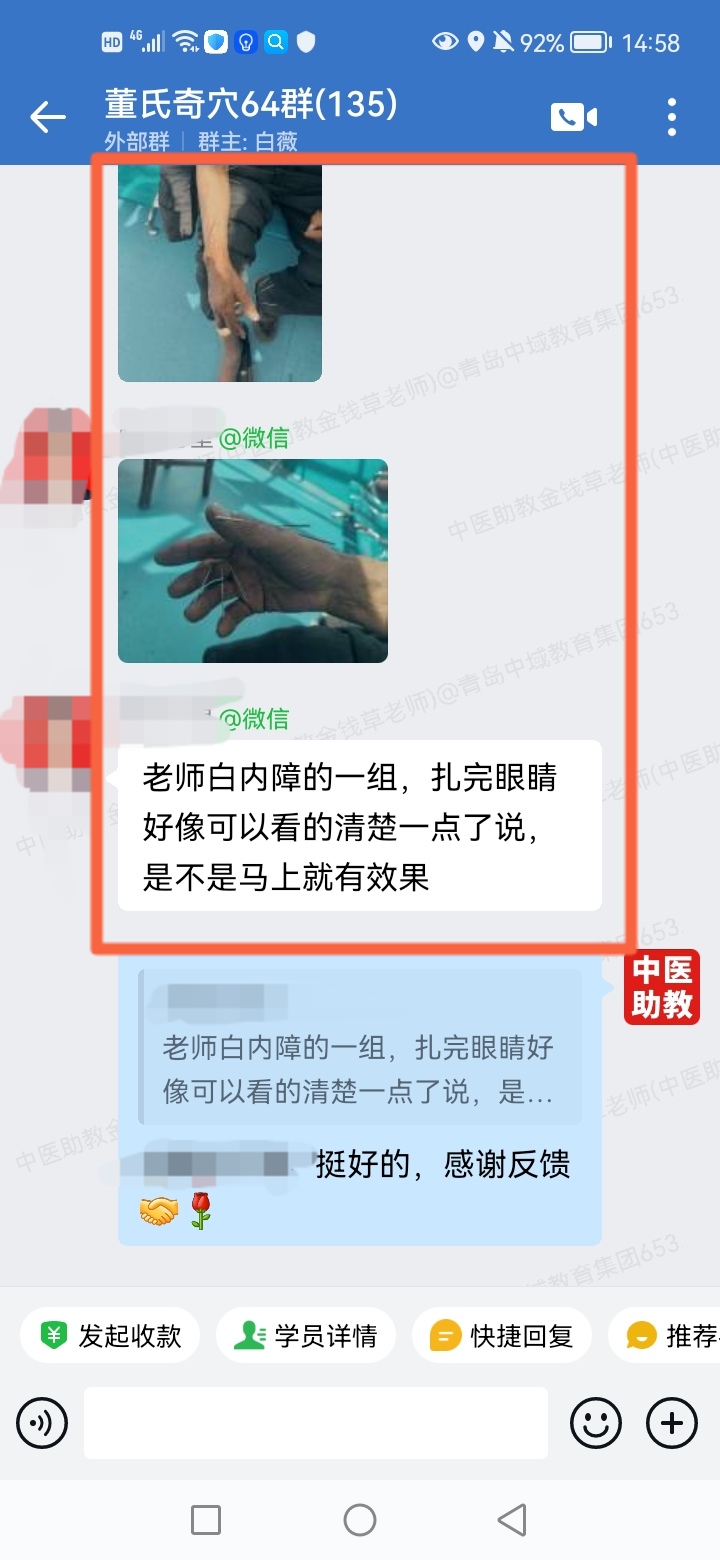 董氏奇穴学员反馈：眼干，口干，白内障等患者以针方调理，改善了！