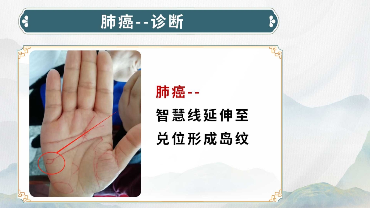 生命全息手诊线下进阶班:中医诊断实用技能,手诊技术系统教学! 生命全息手诊线下进阶班:中医诊断实用技能,手诊技术系统教学!