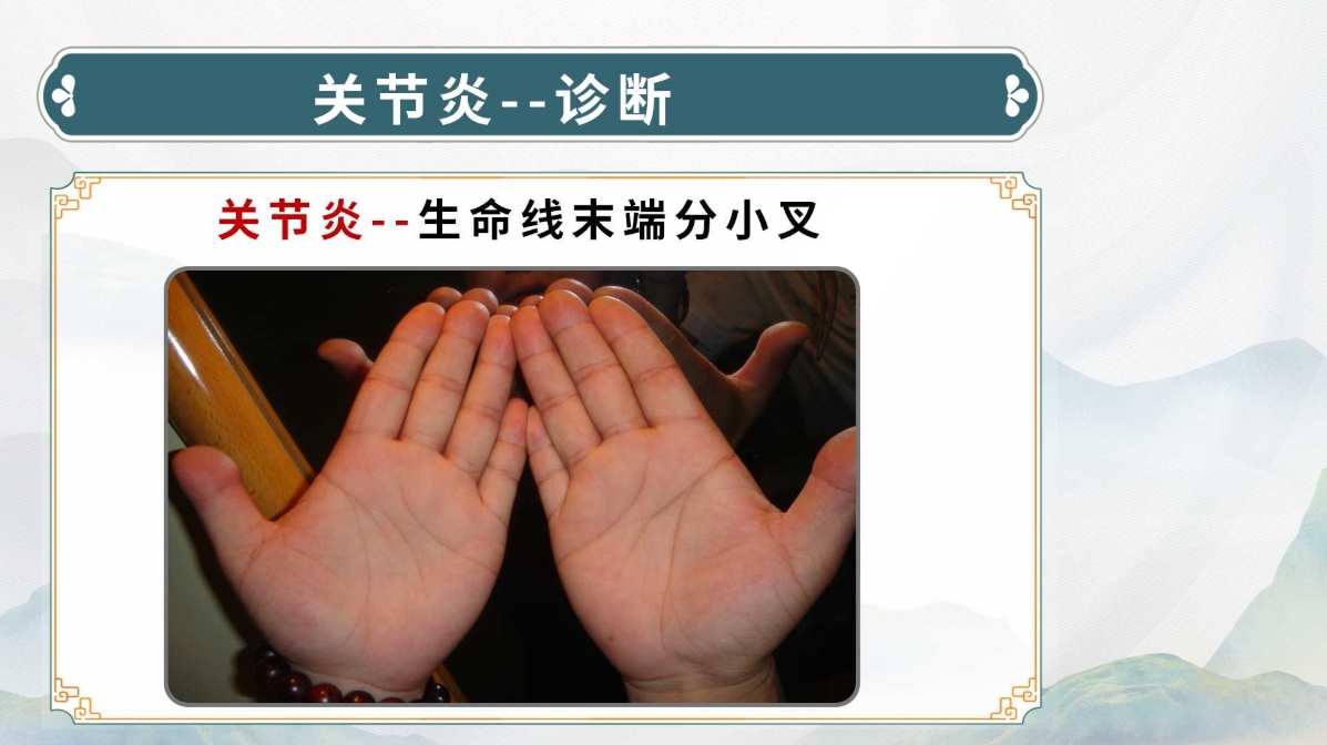 生命全息手诊线下进阶班:中医诊断实用技能,手诊技术系统教学! 生命全息手诊线下进阶班:中医诊断实用技能,手诊技术系统教学!