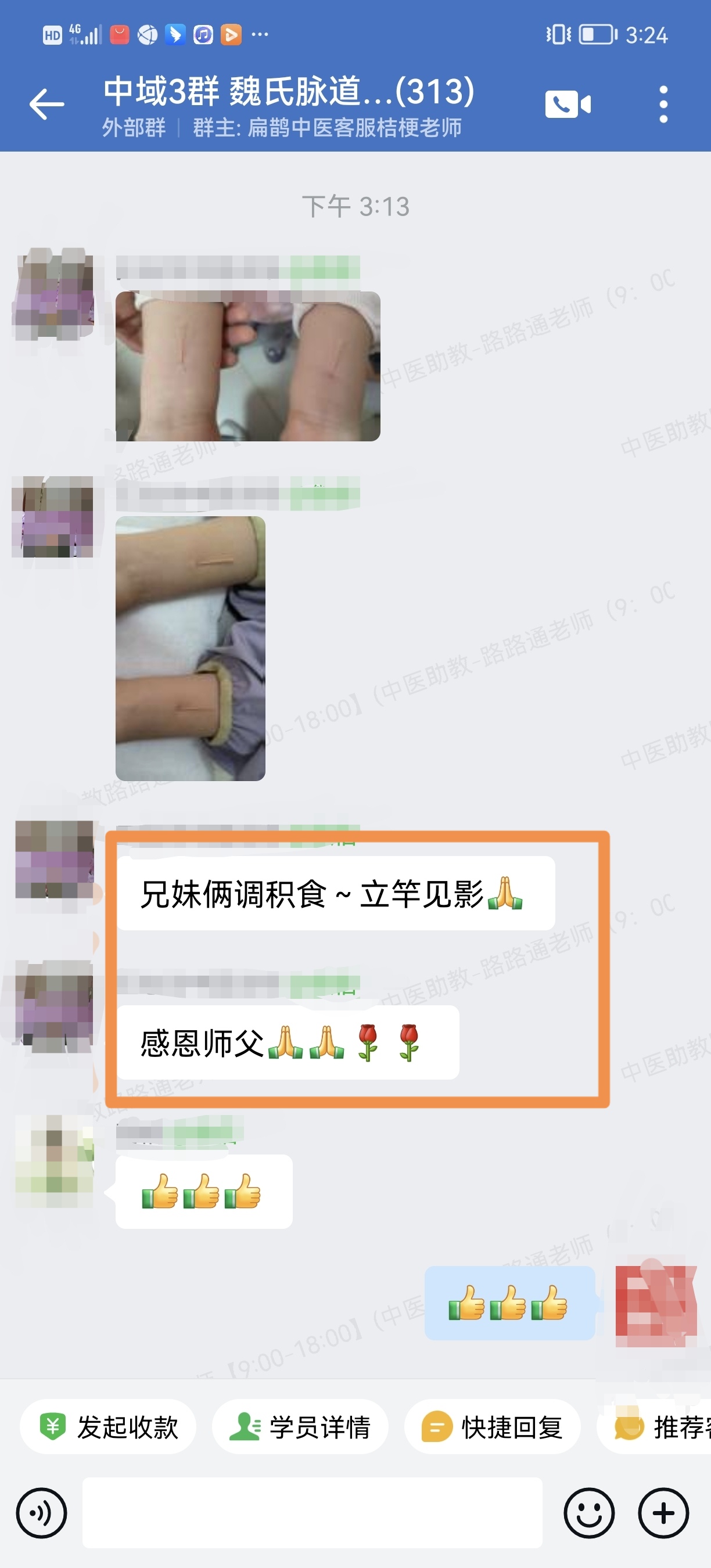 魏氏脉道气血一针通学员反馈：右手发麻、积食等患者，调理后明显好转！