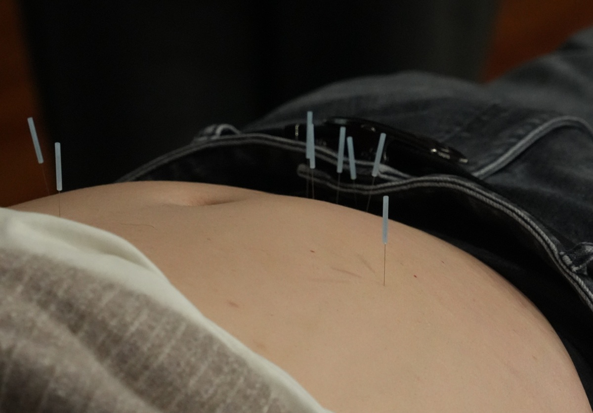 中域教育第14期三生针法学术交流会(北京站)圆满落幕! 中域教育第14期三生针法学术交流会(北京站)圆满落幕!