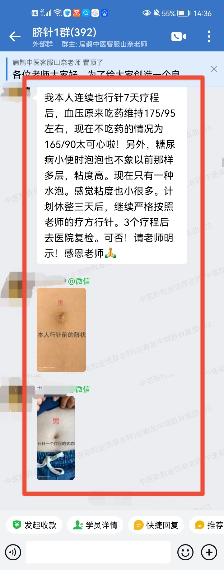 太极八卦脐针学员反馈:高血压调理后改变明显;调理大肚子也变小了! 太极八卦脐针学员反馈:高血压调理后改变明显;调理大肚子也变小了!