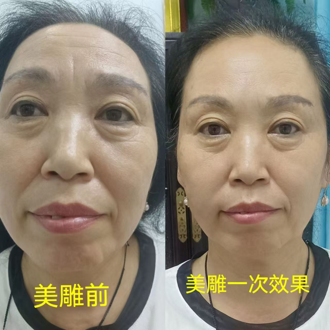 美国飞机上惊险抢回人命!中国非遗 「飞针」绝技震惊全球,20国跪求的神秘医术曝光! 美国飞机上惊险抢回人命!中国非遗 「飞针」绝技震惊全球,20国跪求的神秘医术曝光!