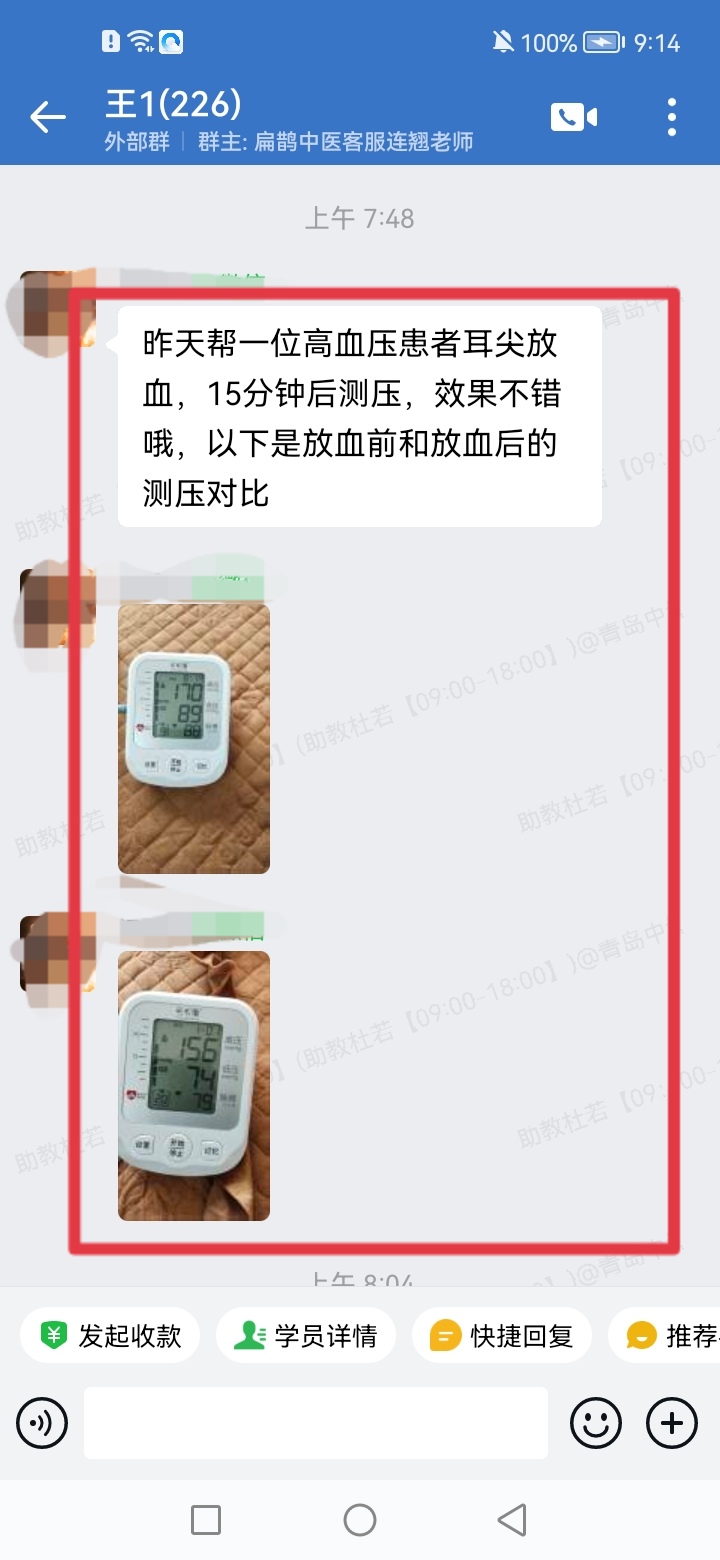 王氏刺血排瘀疗法学员反馈：给高血压患者耳尖放血，血压由170降到了156