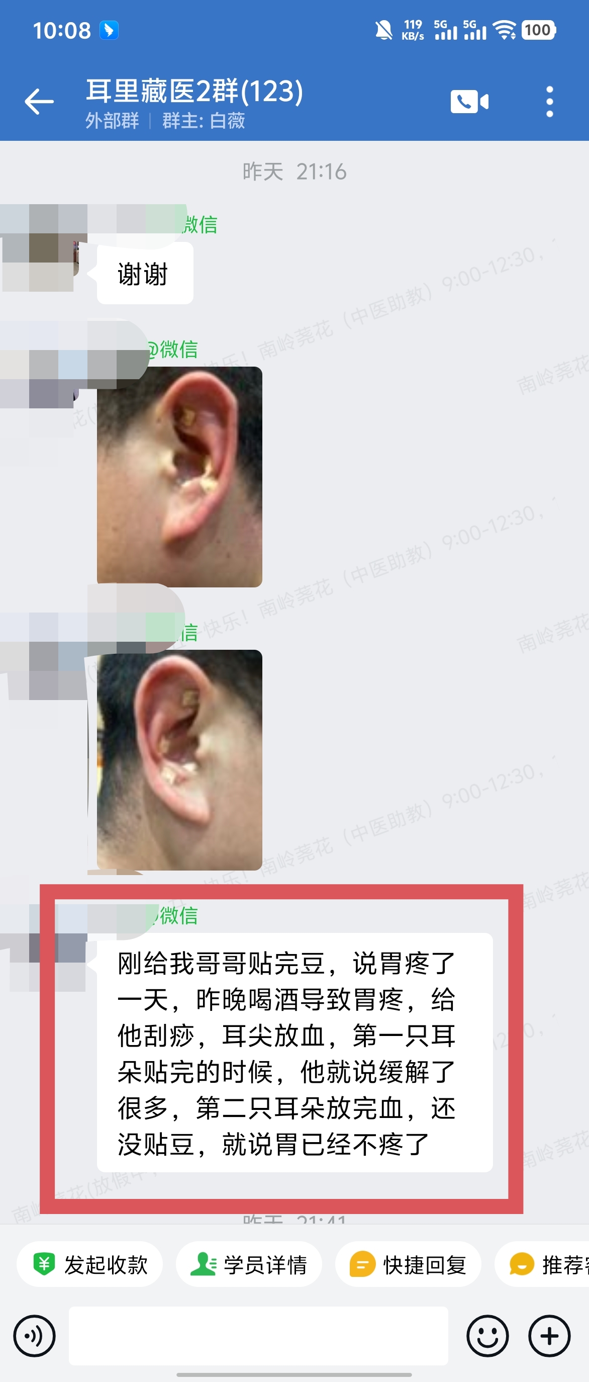 耳里藏医学员反馈:喝酒胃痛用马老师的耳穴贴豆和耳尖放血,当场胃就不疼了! 耳里藏医学员反馈:喝酒胃痛用马老师的耳穴贴豆和耳尖放血,当场胃就不疼了!