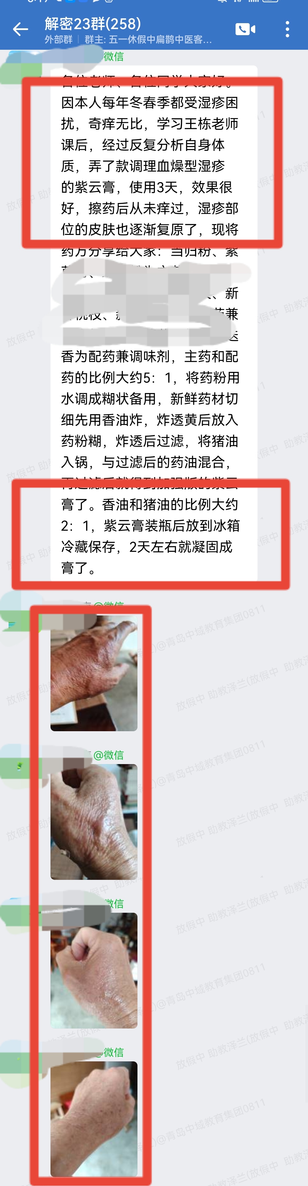 铃医解密学员反馈:用王栋老师紫云膏调理湿疹,3天皮肤逐渐复原! 铃医解密学员反馈:用王栋老师紫云膏调理湿疹,3天皮肤逐渐复原!