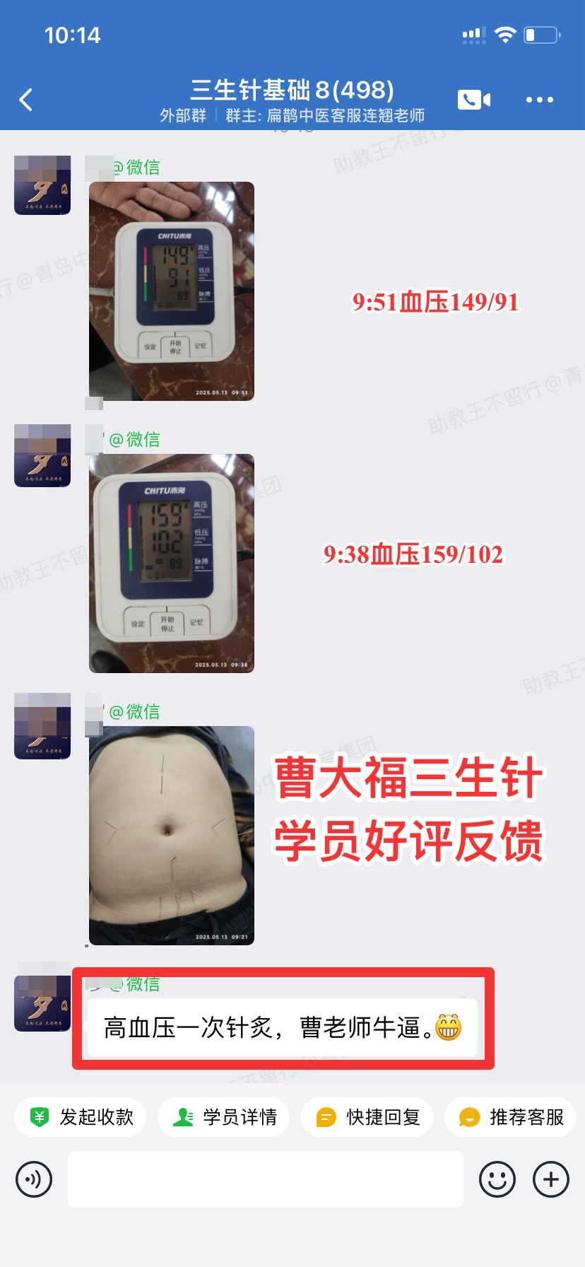 三生针学员反馈：用三生针方调高血压，只扎了10分钟下降10mmHg左右！