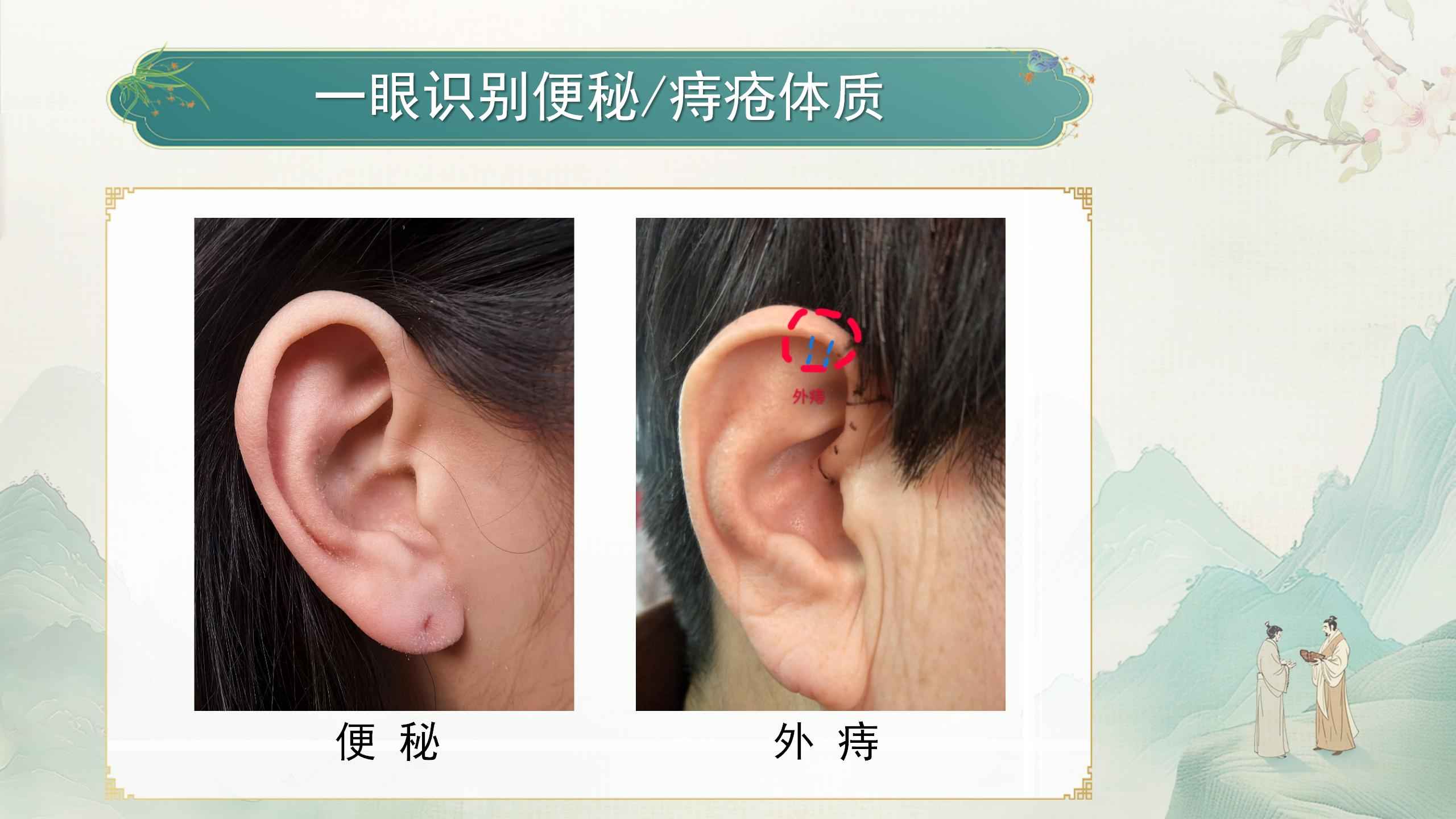 250412elcy115.jpg 250412elcy115.jpg