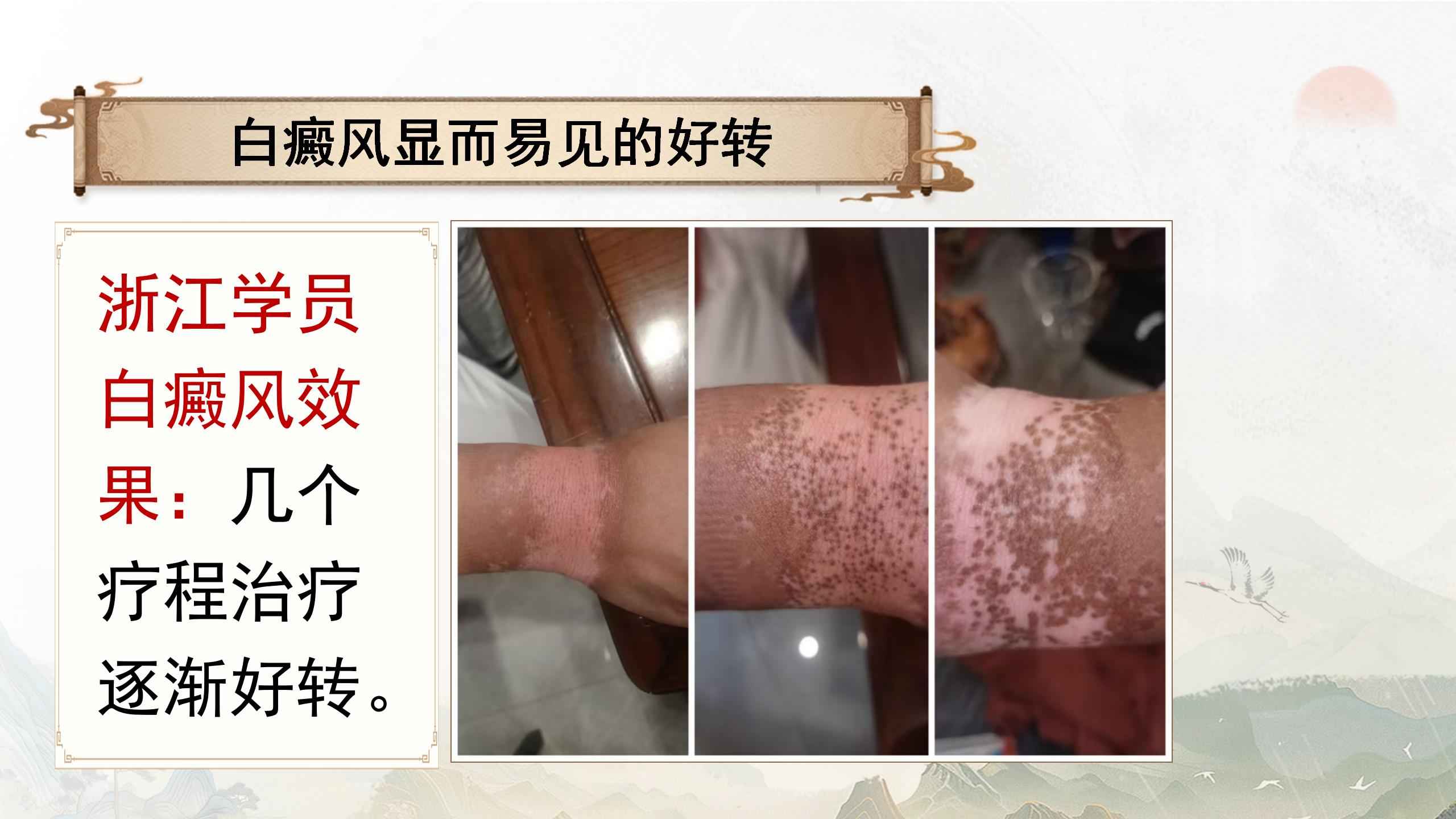 250418msjzyhz43.jpg 250418msjzyhz43.jpg