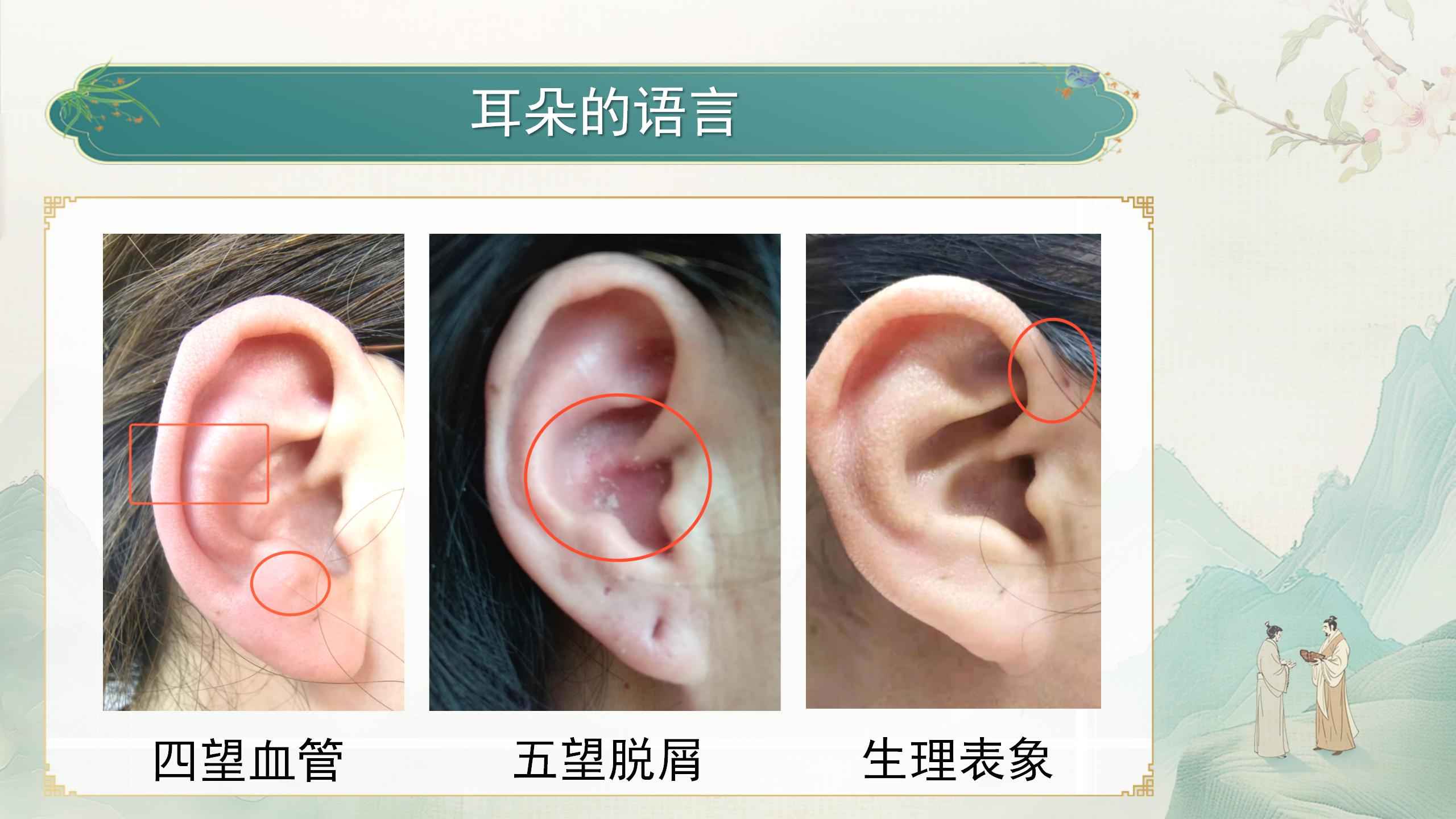 250412elcy41.jpg 250412elcy41.jpg